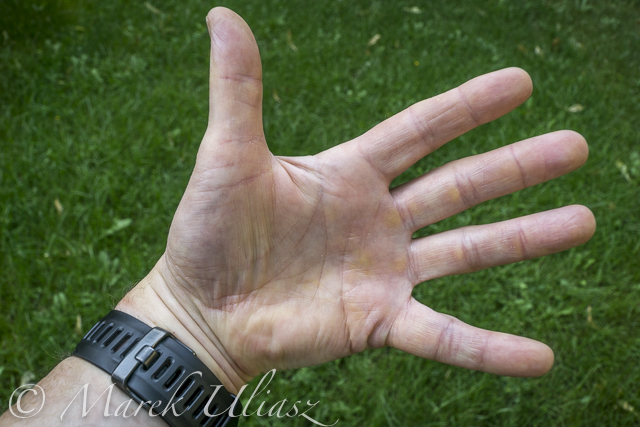 paddler hand after long race